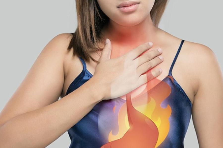 Как быстро избавиться от изжоги: врач назвал 5 простых способов