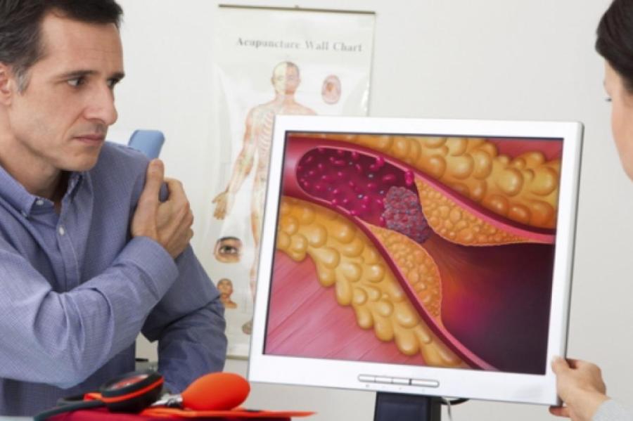 Руки все расскажут: как определить высокий уровень холестерина без анализа крови