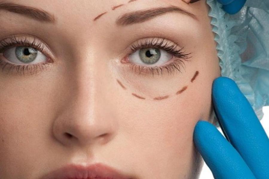 Блефаропластика: мифы и правда