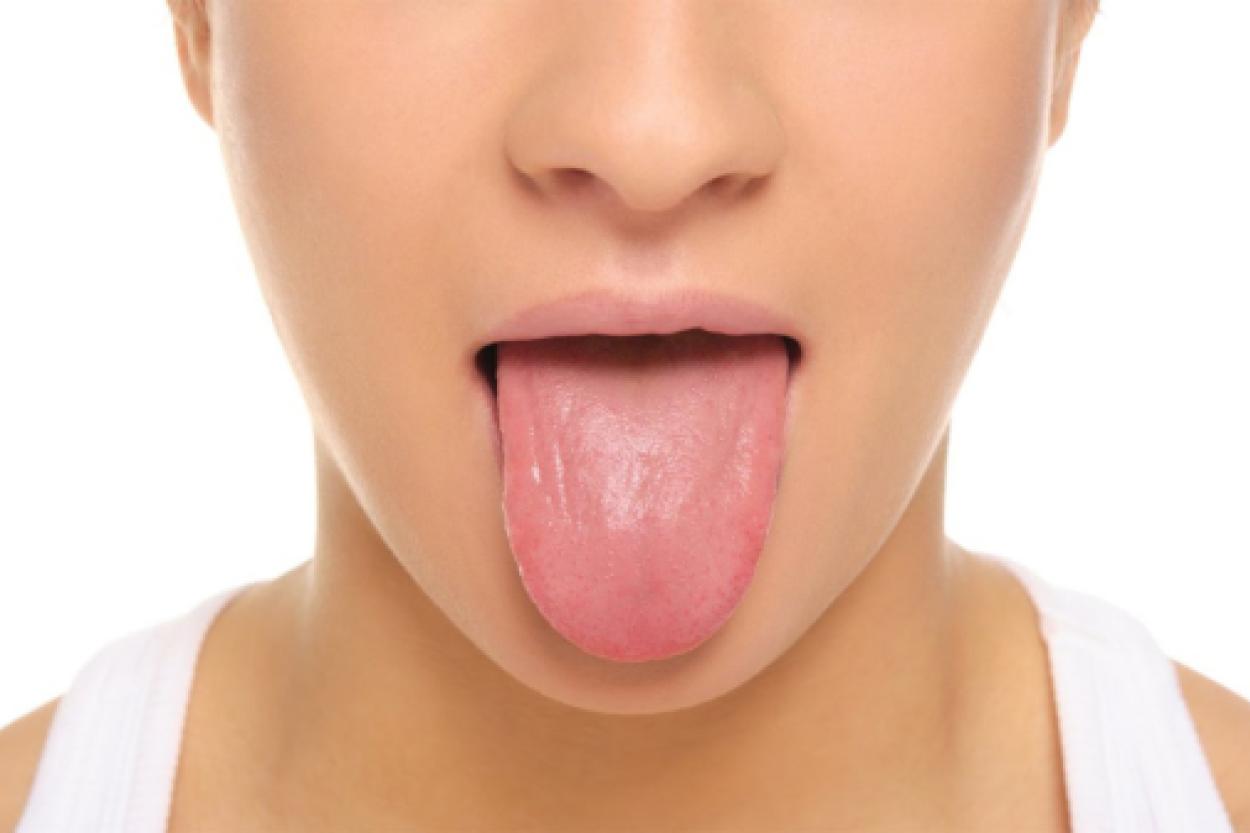 Язык — зеркало здоровья: о чем может рассказать налёт на языке