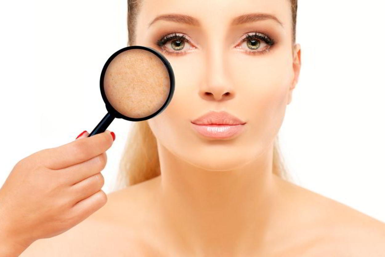 Кожа «помнит» всё: 6 привычек, из-за которых появляются пигментные пятна