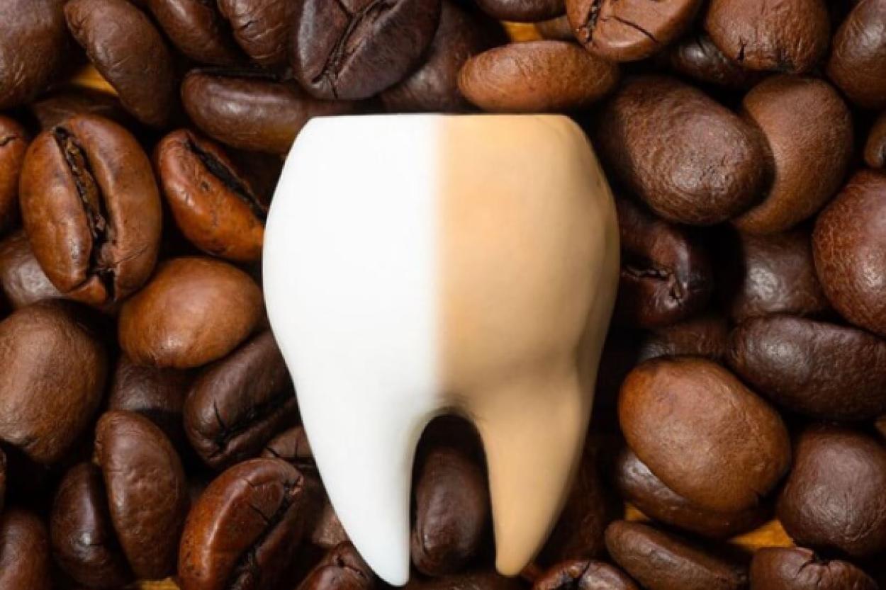 Как сохранить белизну зубов: полезные советы
