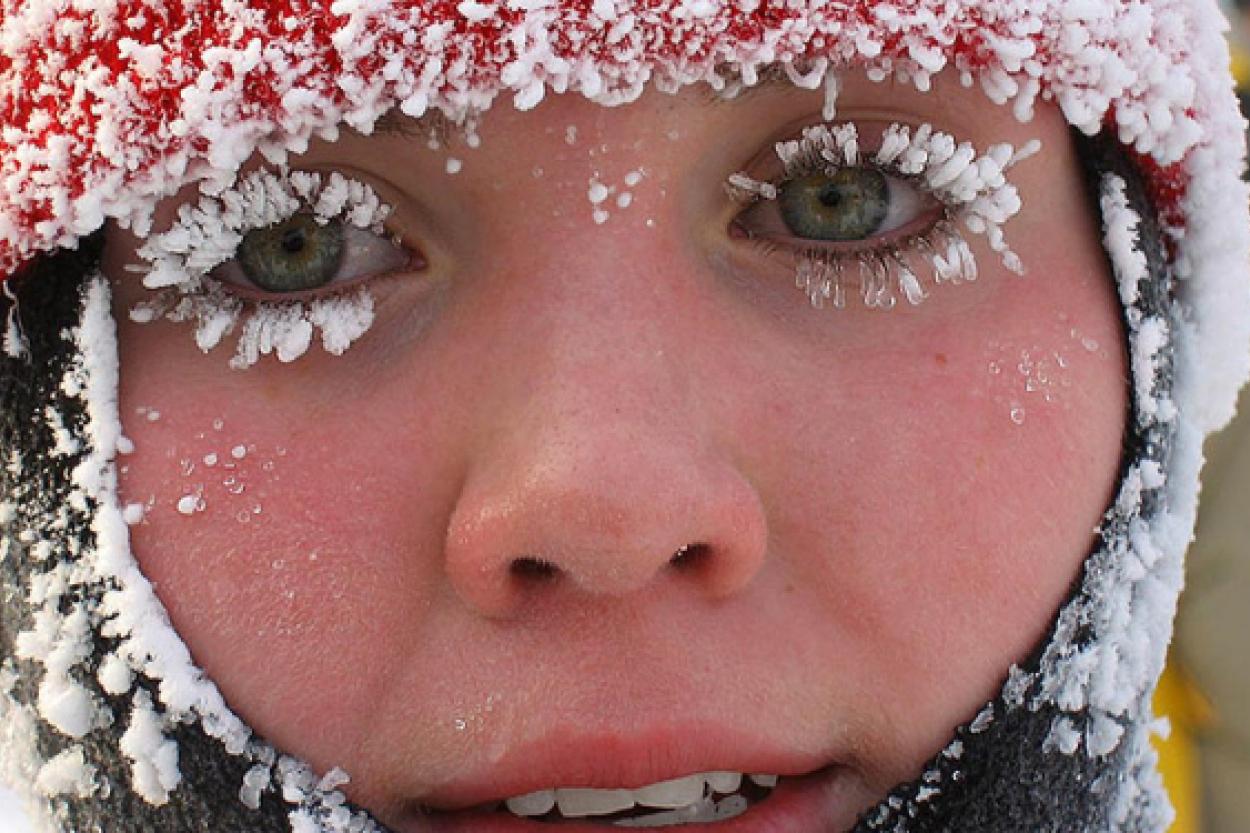 Как быстро восстановить кожу после зимних прогулок