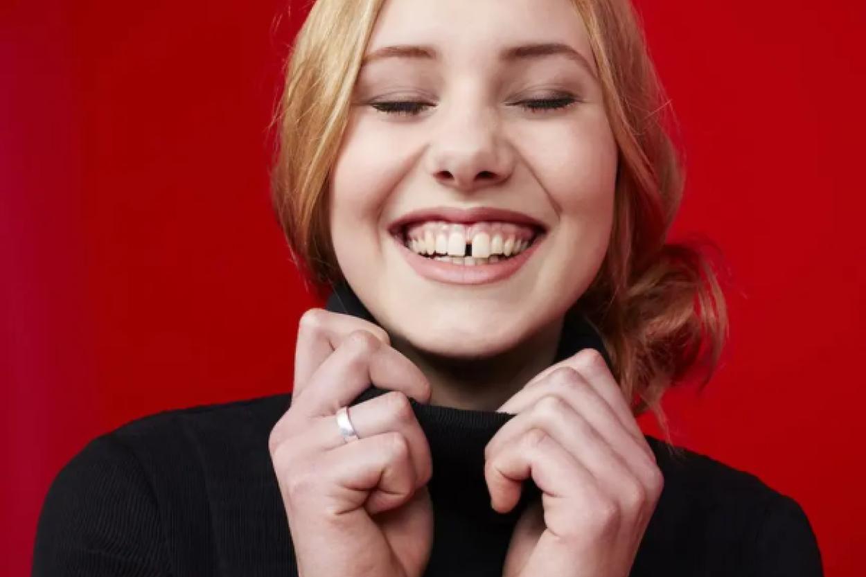 Щербинка между зубами: очаровательная изюминка или повод для волнений