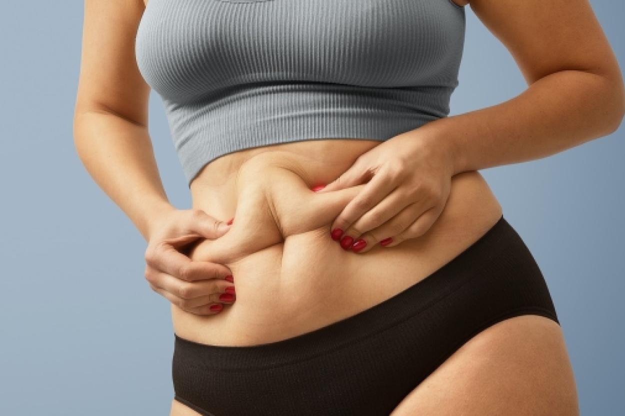 Секреты распределения жира: почему точечно похудеть невозможно