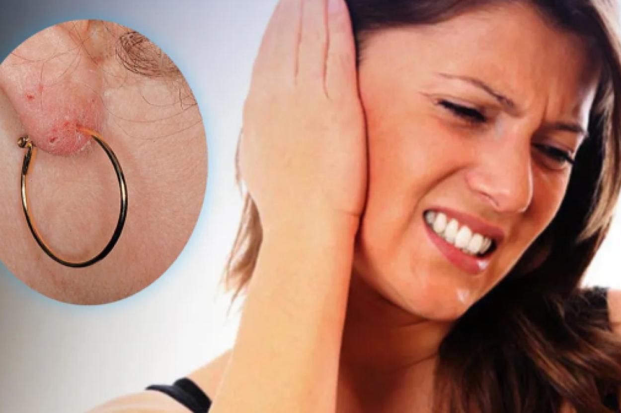 Почему чешутся и краснеют уши от сережек: вся правда об аллергии на бижутерию