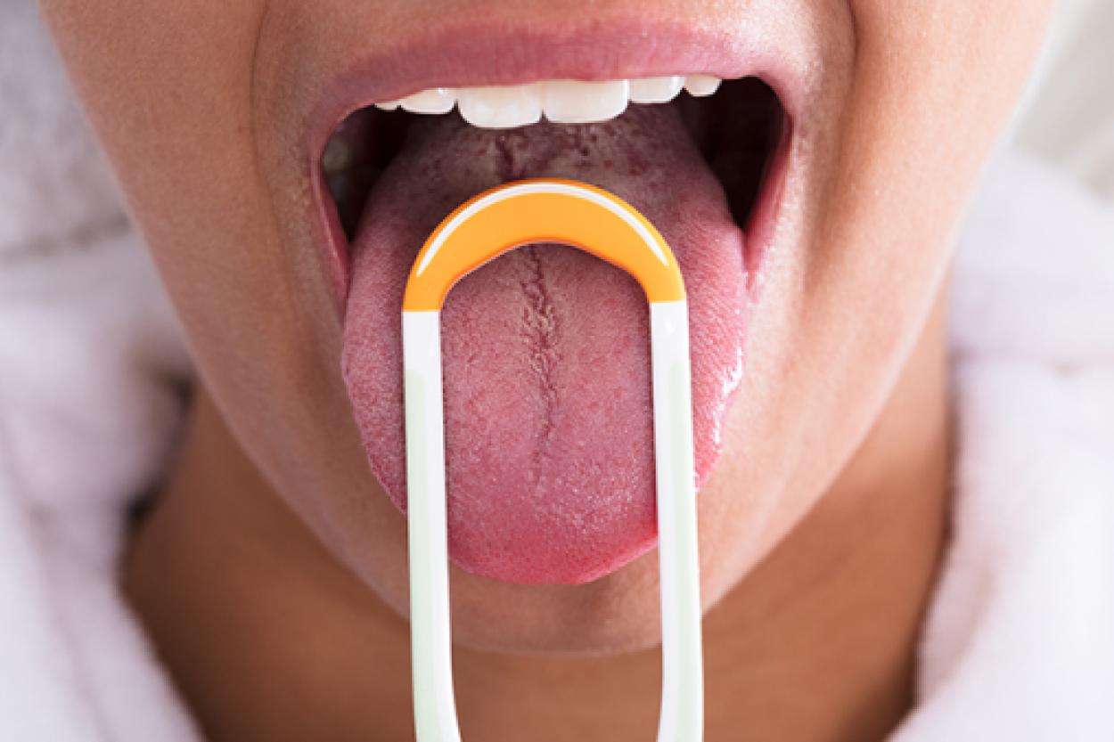 Причины появления налета на языке: что стоит знать