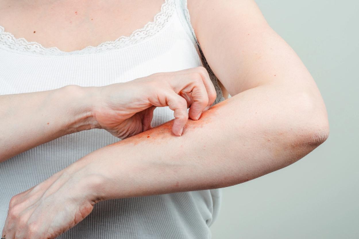 Зуд на коже: что стоит знать о возможных причинах