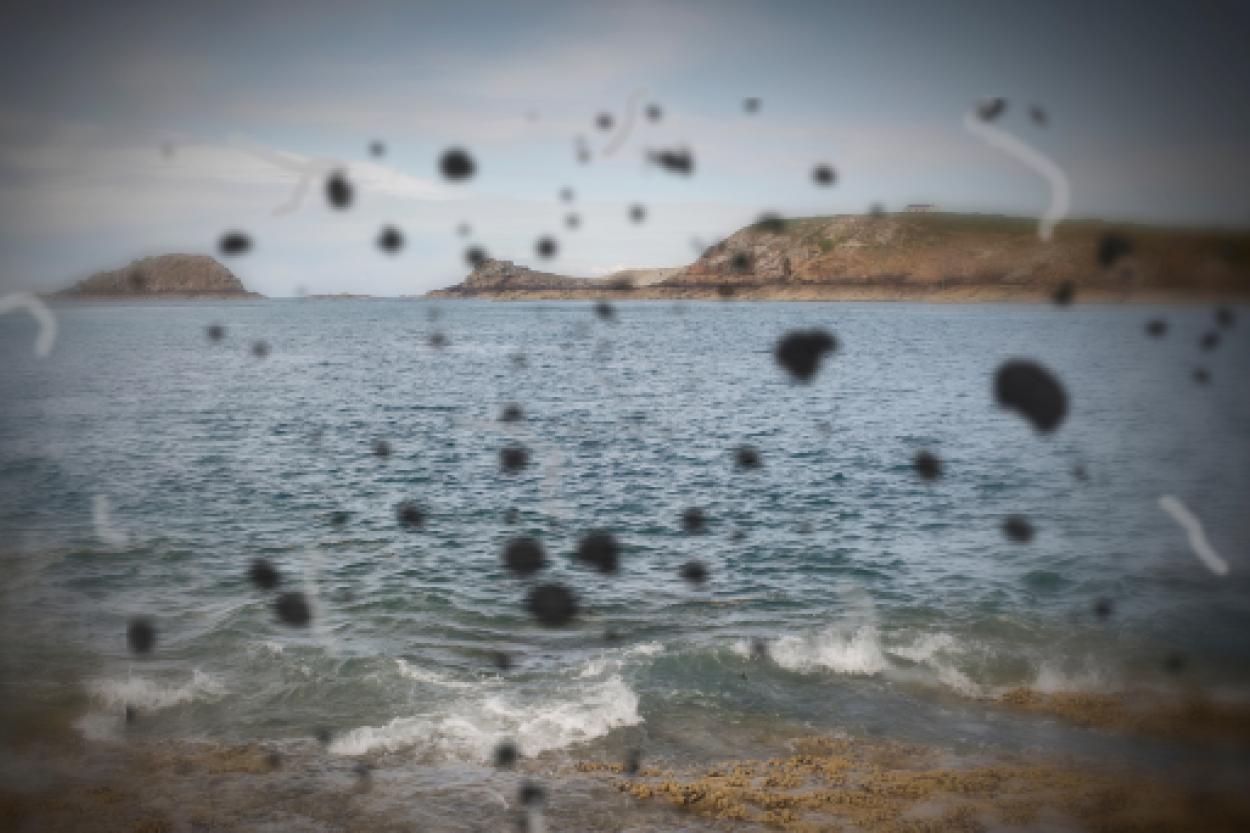 Темные мушки в глазах: когда стоит беспокоиться