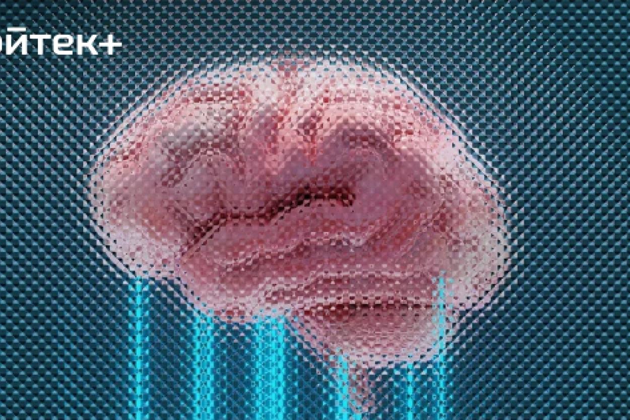 Новая комбинация препаратов снижает риск повторного инсульта на 40%